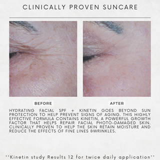 Sonrei Refill- Clearly Zinq® Tinted Hydrating Facial SPF 35 + Growth Factor Sunscreen Mineral Gel/Primer